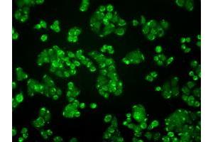 Immunofluorescent staining of HT29 cells using anti-ALDH2 mouse monoclonal antibody (ABIN2452752). (ALDH2 Antikörper)