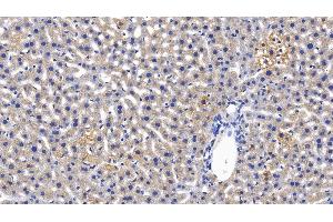 Detection of MBL in Mouse Liver Tissue using Polyclonal Antibody to Mannose Binding Lectin (MBL) (MBL2 Antikörper  (AA 129-244))