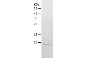 Western Blotting (WB) image for Ubiquitin-Like 3 (UBL3) (AA 1-114) protein (His tag) (ABIN7125637) (UBL3 Protein (AA 1-114) (His tag))