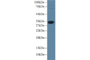 Detection of IGFBP1 in Porcine Liver lysate using Polyclonal Antibody to Insulin Like Growth Factor Binding Protein 1 (IGFBP1) (IGFBPI Antikörper  (AA 112-262))