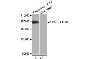 Western blot analysis of extracts of HUVE cells, using Phospho-KDR-Y1175 antibody (ABIN2988109). (VEGFR2/CD309 Antikörper  (pTyr1175))