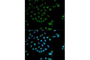 Immunofluorescence analysis of MCF-7 cells using XRCC2 antibody (ABIN5970910). (XRCC2 Antikörper)