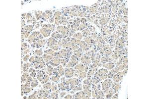 IHC analysis of MGEA5/OGA using anti-MGEA5/OGA antibody (ABIN7602902).