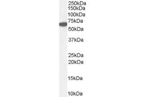 Image no. 1 for anti-Catalase (CAT) (Internal Region) antibody (ABIN374696) (Catalase Antikörper  (Internal Region))