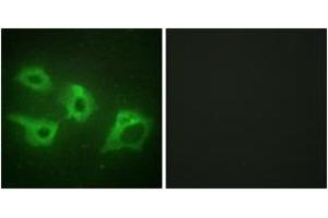 Immunofluorescence analysis of HeLa cells, using CKI-alpha Antibody. (CSNK1A1 Antikörper  (AA 126-175))