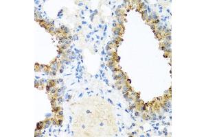 Immunohistochemistry of paraffin-embedded mouse lung using NIN antibody (ABIN6129422, ABIN6144630, ABIN6144632 and ABIN6224239) at dilution of 1:100 (40x lens). (Ninein Antikörper  (AA 1-287))