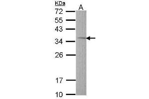 WB Image Sample (30 ug of whole cell lysate) A: Hep G2 , 12% SDS PAGE antibody diluted at 1:1000 (TST Antikörper)