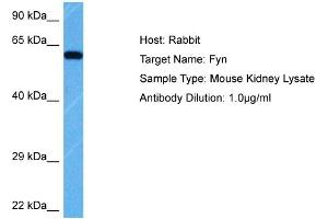 Host: Rabbit Target Name: FYN Sample Tissue: Mouse Kidney Antibody Dilution: 1ug/ml