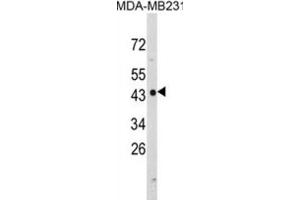 Western Blotting (WB) image for anti-N-Myc Downstream Regulated 1 (NDRG1) antibody (ABIN3002891)