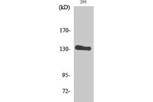 Western Blot analysis of 293 cells using ERBB2 Polyclonal Antibody at dilution of 1:2000. (ErbB2/Her2 Antikörper)
