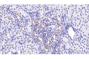 Detection of MAPK9 in Human Kidney Tissue using Polyclonal Antibody to Mitogen Activated Protein Kinase 9 (MAPK9) (JNK2 Antikörper  (AA 130-387))