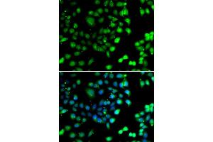 Immunofluorescence analysis of A549 cell using NTMT1 antibody. (METTL11A Antikörper)