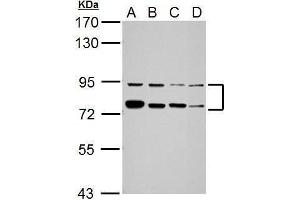 WB Image Sample (30 ug of whole cell lysate) A: Jurkat B: K562 C: THP-1 D: NCI-H929 7. (FUBP1 Antikörper)