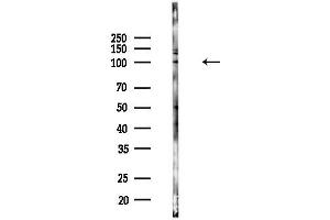 anti-Heat Shock 105kDa/110kDa Protein 1 (HSPH1) (C-Term) antibody