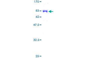 Image no. 1 for Membrane Protein, Palmitoylated 1, 55kDa (MPP1) (AA 1-466) protein (GST tag) (ABIN1311214) (MPP1 Protein (AA 1-466) (GST tag))