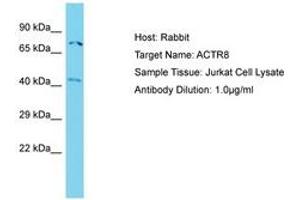 Image no. 1 for anti-ARP8 Actin-Related Protein 8 Homolog (ACTR8) (N-Term) antibody (ABIN6750738) (ACTR8 Antikörper  (N-Term))