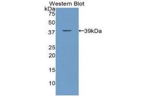 Western Blotting (WB) image for anti-Calcitonin (Calca) (AA 25-85) antibody (ABIN1172938) (Calcitonin Antikörper  (AA 25-85))
