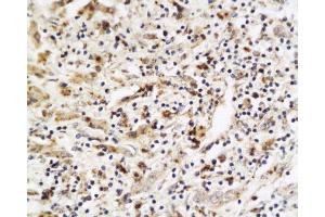 Immunohistochemistry (Paraffin-embedded Sections) (IHC (p)) image for anti-Placenta Growth Factor (PGF) (AA 166-221) antibody (ABIN727235) (PLGF Antikörper  (AA 166-221))