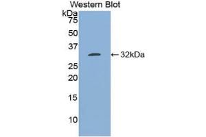 Detection of Recombinant Bcl3, Mouse using Polyclonal Antibody to B-Cell CLL/Lymphoma 3 (Bcl3) (BCL3 Antikörper  (AA 82-341))