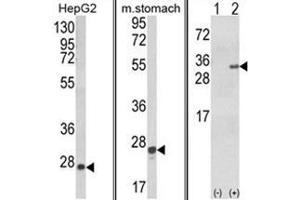 (LEFT) Western blot analysis of GSTA1 Antibody in HepG2 cell line lysates (35ug/lane). (GSTA1 Antikörper)