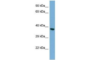 Host: Rabbit Target Name: TWF2 Antibody Dilution: 1. (TWF2 Antikörper  (N-Term))