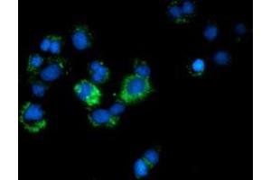 Anti-CALCOCO2 mouse monoclonal antibody (ABIN2453949) immunofluorescent staining of COS7 cells transiently transfected by pCMV6-ENTRY CALCOCO2 (RC203843). (CALCOCO2 Antikörper)