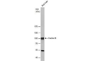 WB Image Factor B antibody [N2C2], Internal detects Factor B protein by western blot analysis. (Complement Factor B Antikörper)