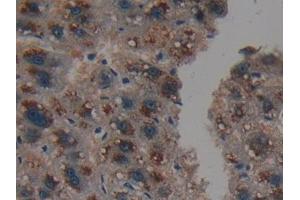 Immunohistochemistry (IHC) image for anti-Proteasome (Prosome, Macropain) 26S Subunit, Non-ATPase, 9 (PSMD9) (AA 2-223) antibody (ABIN7442213)