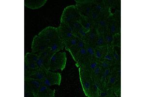 Immunofluorescence - anti-beta-Actin Ab at 1/100 dilution in NHl/3T3 cells, cells were fixed with methanol and permeabilized with 0. (beta Actin Antikörper  (N-Term))