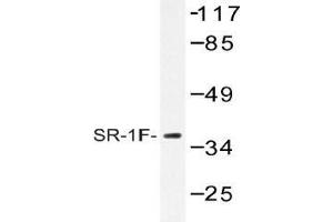 Western blot (WB) analysis of SR-1F antibody in extracts from COS-7 cells. (HTR1F Antikörper)