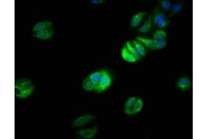 Immunofluorescence staining of HepG2 cells with ABIN7151234 at 1:66, counter-stained with DAPI. (TRAF7 Antikörper  (AA 1-90))