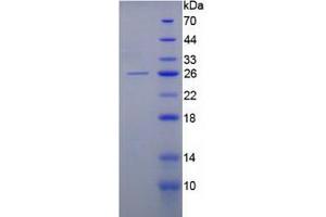 SDS-PAGE analysis of Human Keratin 8 Protein. (KRT8 Protein)