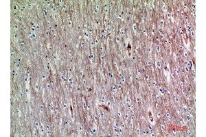 Immunohistochemical analysis of paraffin-embedded human-brain, antibody was diluted at 1:200
