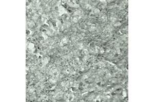 IHC on mouse brain (cryo section) using Rabbit antibody to Synaptotagmin 17  at a concentration of 50 µg/ml incubated overnight at 4C. (SYT17 Antikörper  (Internal Region))