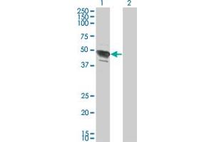 Western Blot analysis of TFAP2B expression in transfected 293T cell line by TFAP2B monoclonal antibody (M02), clone 2F6.