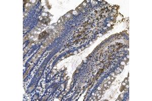IHC analysis of LPP using anti LPP antibody (ABIN7602831). (LPP Antikörper  (C-Term))