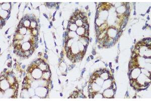 Immunohistochemistry of paraffin-embedded Human colon using ECH1 Polyclonal Antibody at dilution of 1:150 (40x lens). (ECH1 Antikörper)