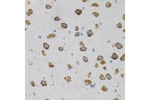 Immunohistochemistry of paraffin-embedded mouse brain using VEGFC antibody. (VEGFC Antikörper)