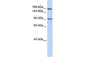 Human Lung; WB Suggested Anti-AFF2 Antibody Titration: 0. (AFF2 Antikörper  (Middle Region))