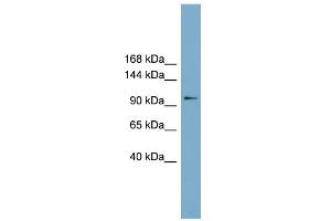 WB Suggested Anti-FTSJD1 Antibody Titration: 0. (CMTR2 Antikörper  (Middle Region))