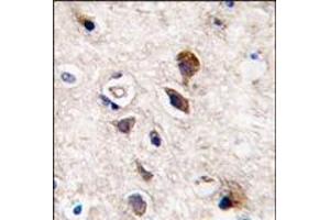 Formalin-fixed and paraffin-embedded human brain tissue reacted with PKC gamma antibody (C-term), which was peroxidase-conjugated to the secondary antibody, followed by DAB staining. (PKC gamma Antikörper  (C-Term))