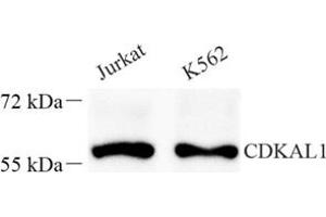 Western blot analysis of Cdkal1 (ABIN7073414) at dilution of 1: 400 (CDKAL1 Antikörper)