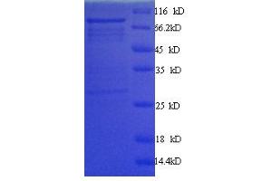 SDS-PAGE (SDS) image for Myc Proto-Oncogene protein (MYC) (AA 1-439) protein (His tag) (ABIN1047410)