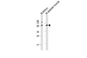 All lanes : Anti-Acvr2b Antibody (Center) at 1:1000 dilution Lane 1: mouse kidney lysate Lane 2: mouse skeletal muscle lysate Lysates/proteins at 20 μg per lane.