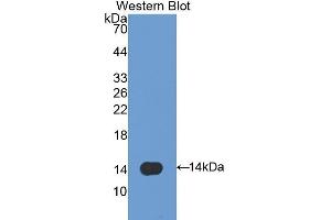 Western Blotting (WB) image for anti-Caveolin 1, Caveolae Protein, 22kDa (CAV1) (AA 2-105) antibody (ABIN1172557) (Caveolin-1 Antikörper  (AA 2-105))