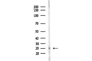 Western blot analysis of lysates from F10-LUC cells(starvation,24h treatment), using LDOC1L Antibody at 1/1000 dilution.