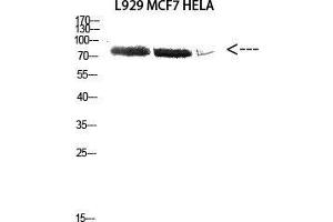 Western Blot (WB) analysis of L929 MCF7 HeLa cells using Antibody diluted at 2000. (DDX3X Antikörper  (Lys8))