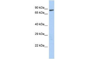 Western Blotting (WB) image for anti-LAS1-Like (LAS1L) (Middle Region) antibody (ABIN2775919)