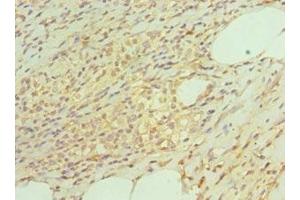 Immunohistochemistry of paraffin-embedded human epityphlon tissue using ABIN7164899 at dilution of 1:100 (TAC1 Antikörper  (AA 1-129))