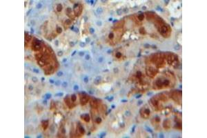 IHC-P analysis of Kidney tissue, with DAB staining. (CPB1 Antikörper  (AA 111-417))